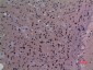 TudorSN Polyclonal Antibody